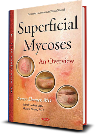 superficial Mycoses